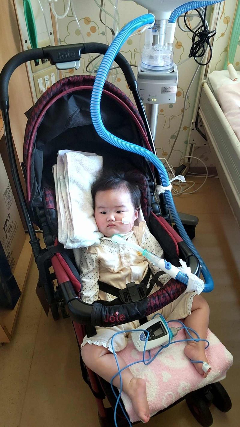 人工呼吸器の固定イメージ